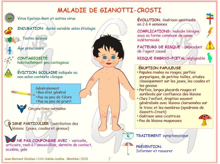 Acrodermatite Papuleuse Infantile De Gianotti Crosti developpement des enfants les maladies